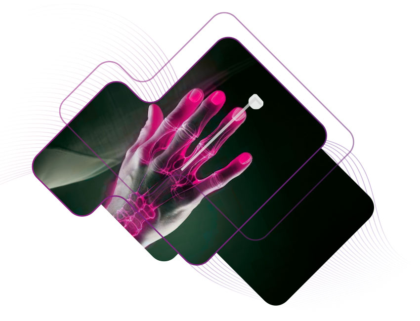 foto-produtos-chiroa