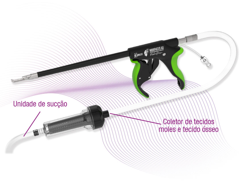 foto-produtos-rebe6